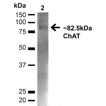 Choline Acetyltransferase Antibody: HRP
