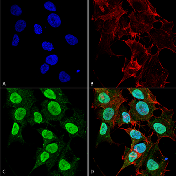 Cav1.2 Antibody