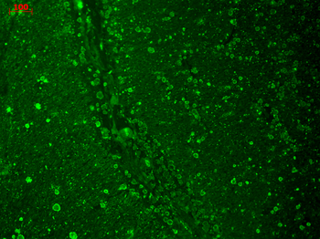 Cav1.2 Antibody