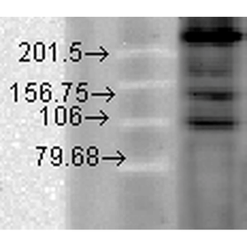 Cav1.2 Antibody