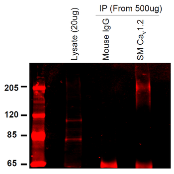 Cav1.2 Antibody