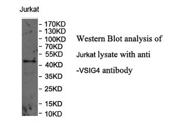VSIG4 Rabbit Polyclonal Antibody