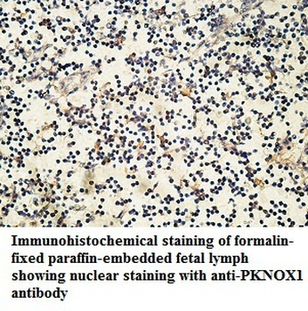 PKNOX1 Rabbit Polyclonal Antibody
