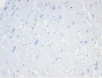 Recombinant CD20 / MS4A1 (B-Cell Marker) Antibody