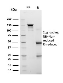 Fatty Acid Binding Protein 4 (FABP4) Antibody