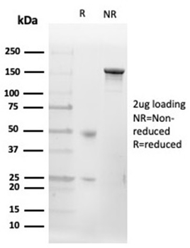 CD20 / MS4A1 (B-Cell Marker) Antibody
