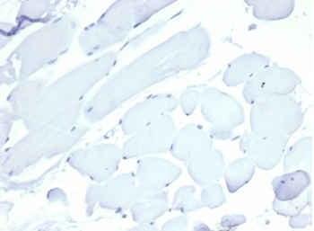 NCL Antibody