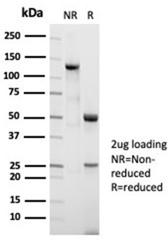 NCL Antibody