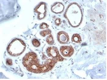 IGF1R Antibody