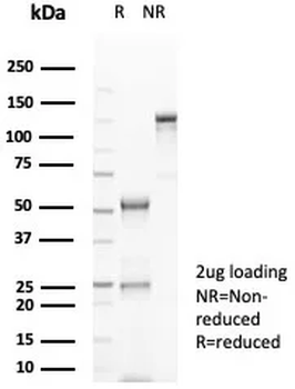 Recombinant CD20 / MS4A1 (B-Cell Marker) Antibody