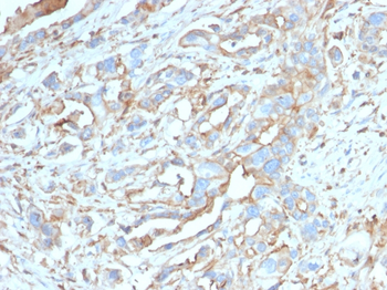 PD-L1 / PDCD1LG1 / CD274 / B7-H1 (Cancer Immunotherapy Target) Antibody