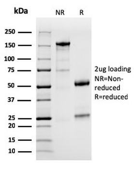 PD-L1 / PDCD1LG1 / CD274 / B7-H1 (Cancer Immunotherapy Target) Antibody