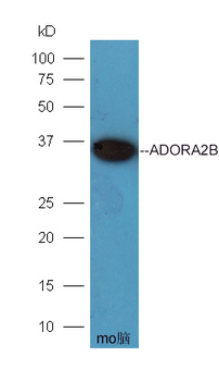 ADORA2B antibody