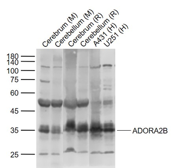 ADORA2B antibody