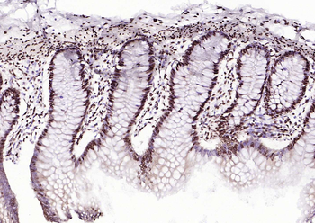 B MyB antibody