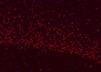 B MyB antibody