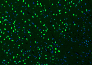 B MyB antibody