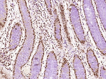 B MyB antibody