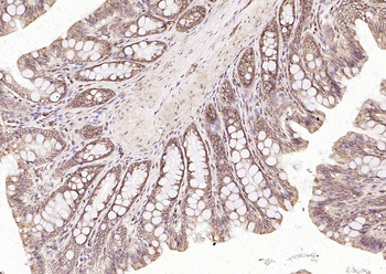 Frizzled 5 antibody