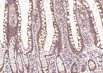 Frizzled 5 antibody