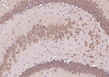 Frizzled 5 antibody