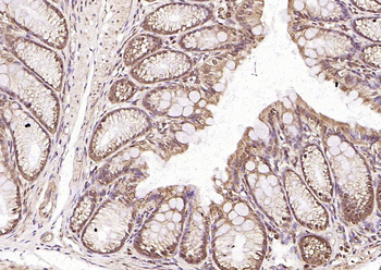 Frizzled 5 antibody