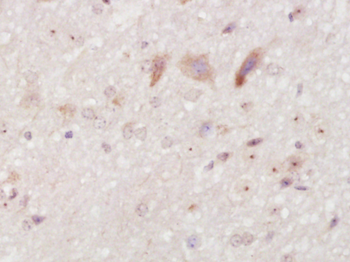 PCSK9 antibody