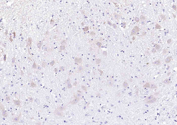 PCSK9 antibody