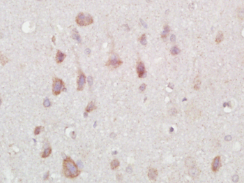 PCSK9 antibody