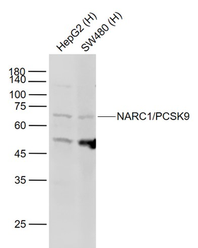 PCSK9 antibody