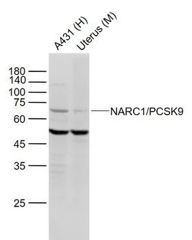 PCSK9 antibody