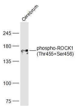 ROCK1 (phospho-Thr455/Ser456) antibody