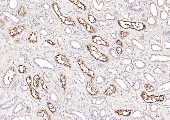 ACE2 antibody