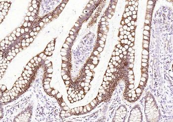 TM4SF3 antibody