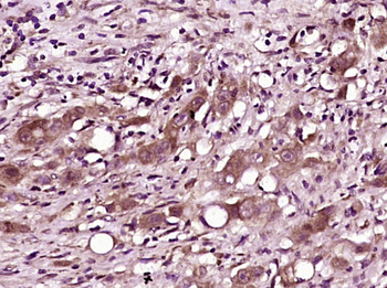 TMS1 antibody