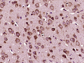 TMS1 antibody