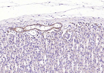 ACTA2 antibody