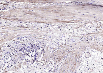 ACTA2 antibody