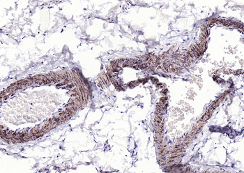 ACTA2 antibody