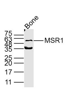 MSR1 antibody