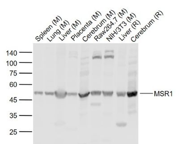 MSR1 antibody