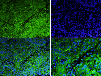 MSR1 antibody