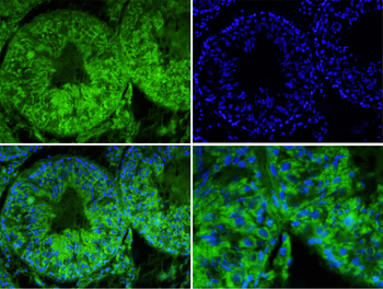 MSR1 antibody