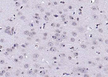 AEBP1 antibody