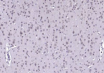 AEBP1 antibody