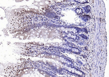 AEBP1 antibody