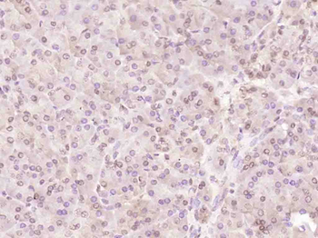 BCL2 antibody