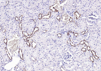 AT2R Rabbit Polyclonal Antibody