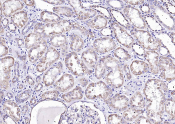 Angiopoietin 1 antibody