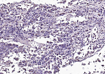 Angiopoietin 1 antibody